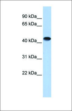 Anti-CKM (ab2) antibody produced in rabbit affinity isolated antibody