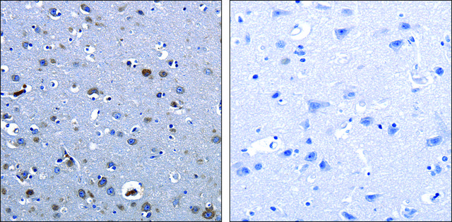 Anti-CBFA1 antibody produced in rabbit affinity isolated antibody