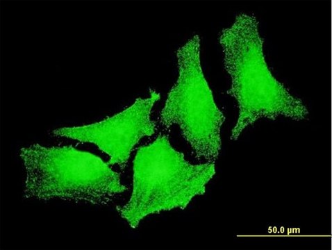 Monoclonal Anti-CYGB antibody produced in mouse clone 3A5-2D2, purified immunoglobulin, buffered aqueous solution