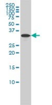 Monoclonal Anti-RABGGTB antibody produced in mouse clone 1C2, purified immunoglobulin, buffered aqueous solution