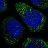 Anti-THSD1 antibody produced in rabbit Prestige Antibodies® Powered by Atlas Antibodies, affinity isolated antibody, buffered aqueous glycerol solution