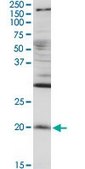 Anti-RGS5 antibody produced in rabbit purified immunoglobulin, buffered aqueous solution