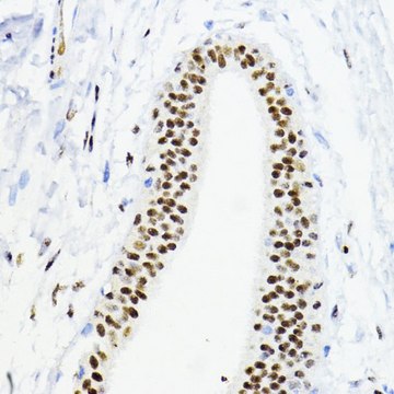 Anti-ZEB1 antibody produced in rabbit