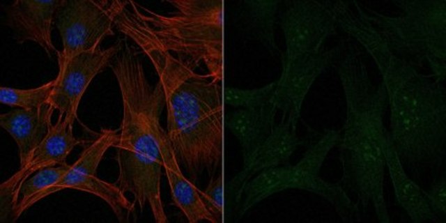 Anti-Interleukin-1&#946; Antibody, Alexa Fluor&#8482; 488 Conjugate from rabbit, ALEXA FLUOR&#8482; 488