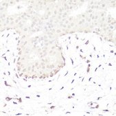Anti-GLI1 antibody produced in rabbit