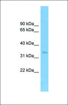 Anti-SSR1 antibody produced in rabbit affinity isolated antibody