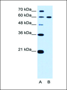 Anti-DTX2 antibody produced in rabbit affinity isolated antibody