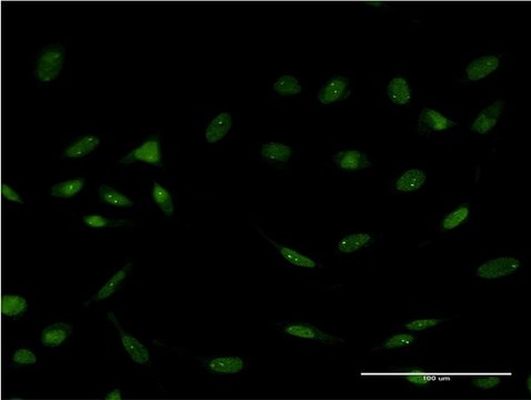 ANTI-FOXC2 antibody produced in mouse clone 1D4, purified immunoglobulin, buffered aqueous solution