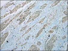 抗-GLI2 affinity isolated antibody