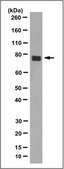 Anti-Fibulin-1 Antibody, clone 3D12.1 clone 3D12.1, from mouse