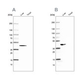 Anti-FAH antibody produced in rabbit Prestige Antibodies® Powered by Atlas Antibodies, affinity isolated antibody, buffered aqueous glycerol solution