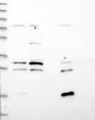 Anti-NCEH1 antibody produced in rabbit Prestige Antibodies® Powered by Atlas Antibodies, affinity isolated antibody, buffered aqueous glycerol solution