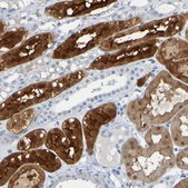 Anti-ACMSD antibody produced in rabbit Prestige Antibodies® Powered by Atlas Antibodies, affinity isolated antibody, buffered aqueous glycerol solution