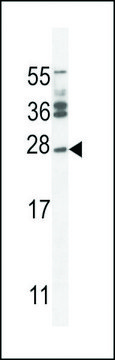 ANTI-JOSD2(N-TERMINAL) antibody produced in rabbit affinity isolated antibody, buffered aqueous solution