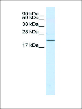 Anti-SCN3B affinity isolated antibody