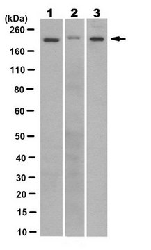 Anti-ZCCHC11 (TUT4) Antibody, clone 9F6.1 clone 9F6.1, from mouse