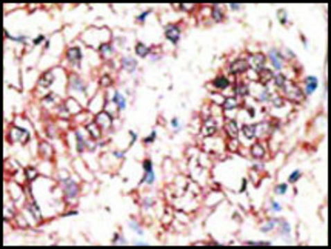 Anti-NRG3 (center) antibody produced in rabbit IgG fraction of antiserum, buffered aqueous solution