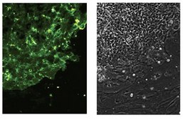 Anti-Stage-Specific Embryonic Antigen-3 Antibody, clone MC-631 clone MC-631, from rat