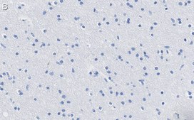 Anti-KCNQ2 Antibody, clone 2G18 ZooMAb® Rabbit Monoclonal recombinant, expressed in HEK 293 cells