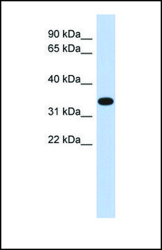 Anti-ACTRT1 antibody produced in rabbit affinity isolated antibody