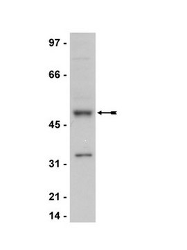 Anti-Cyclin E Antibody Upstate&#174;, from rabbit