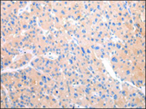 Anti-ZNF106 affinity isolated antibody