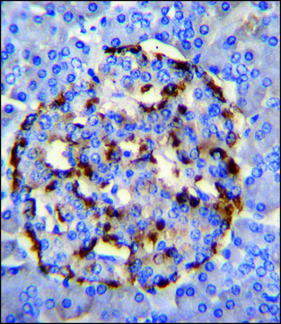 ANTI-PLA2G2D (C-TERM) antibody produced in rabbit IgG fraction of antiserum, buffered aqueous solution