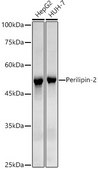 Anti-Perilipin-2 Antibody, clone 9W7Y9, Rabbit Monoclonal