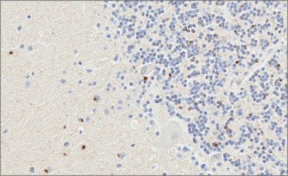 Anti-C9ORF72/C9RANT (poly-GP) Antibody from rabbit