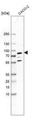 Anti-GYS2 antibody produced in rabbit Prestige Antibodies® Powered by Atlas Antibodies, affinity isolated antibody, buffered aqueous glycerol solution