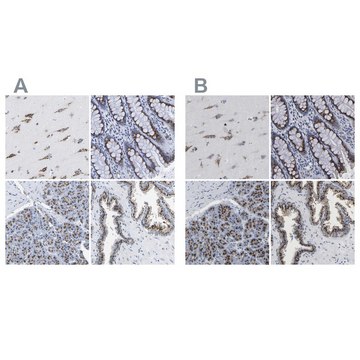 Anti-TMEM87A antibody produced in rabbit Prestige Antibodies&#174; Powered by Atlas Antibodies, affinity isolated antibody, buffered aqueous glycerol solution