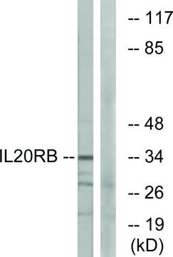 Anti-IL20RB antibody produced in rabbit affinity isolated antibody