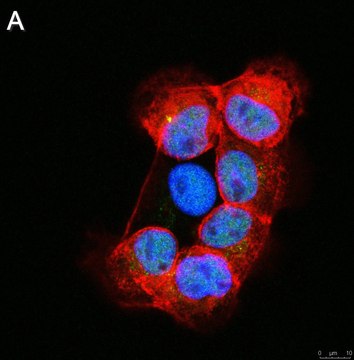 Anti-RFX7 Antibody, clone 1J22 ZooMAb&#174; Rabbit Monoclonal recombinant, expressed in HEK 293 cells