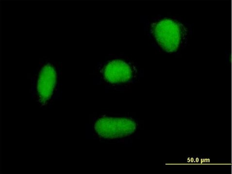 Anti-ELAC2 antibody produced in mouse purified immunoglobulin, buffered aqueous solution