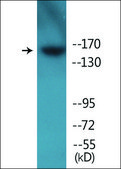 Anti-phospho-IR (pTyr1355) antibody produced in rabbit affinity isolated antibody