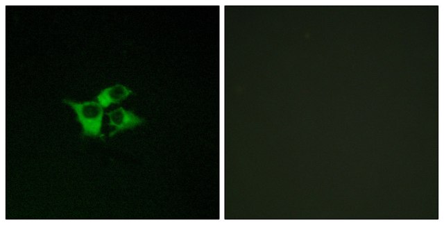 Anti-EDNRA antibody produced in rabbit affinity isolated antibody