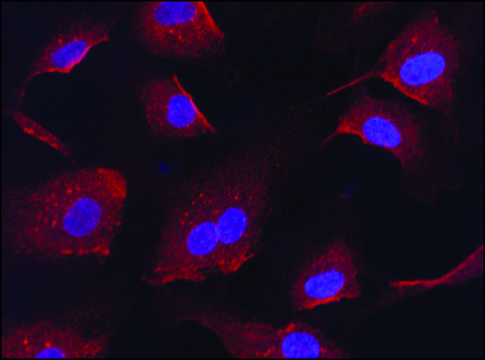 Anti-Anti-RanGAP1 (C-terminal) 兔抗 ~1&#160;mg/mL, affinity isolated antibody, buffered aqueous solution