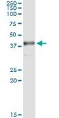 Monoclonal Anti-SDSL antibody produced in mouse clone 1D6-6B8, ascites fluid