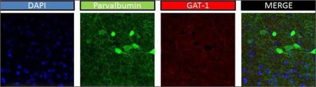 Anti-SLC6A1 antibody produced in rabbit affinity isolated antibody