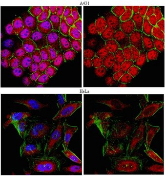 Anti-HDAC4 Antibody serum, from rabbit