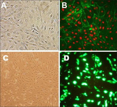 Human Lung Microvascular Endothelial Cells: HLMVEC, adult