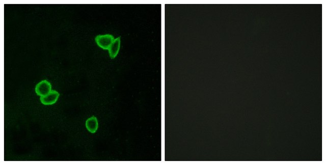 Anti-LPHN1 antibody produced in rabbit affinity isolated antibody