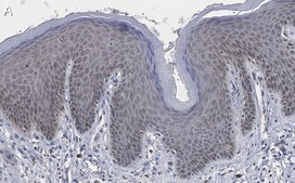 Anti-TLR4 Antibody, clone 2N20 ZooMAb® Rabbit Monoclonal recombinant, expressed in HEK 293 cells