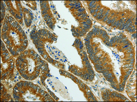 Anti-SPAG4 affinity isolated antibody