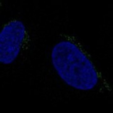 Anti-ALKBH7 antibody produced in rabbit Prestige Antibodies&#174; Powered by Atlas Antibodies, affinity isolated antibody, buffered aqueous glycerol solution