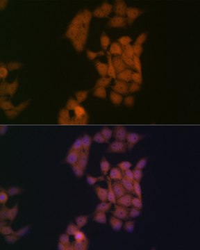 Anti-Kaiso/ZBTB33 Antibody, clone 10O4V2, Rabbit Monoclonal