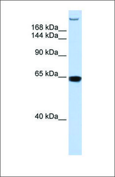 Anti-TNRC6A antibody produced in rabbit affinity isolated antibody