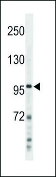 ANTI-NFKB(P100) (C-TERM S866/870) antibody produced in rabbit affinity isolated antibody, buffered aqueous solution