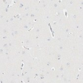 Anti-IKZF3 antibody produced in rabbit Prestige Antibodies® Powered by Atlas Antibodies, affinity isolated antibody, buffered aqueous glycerol solution