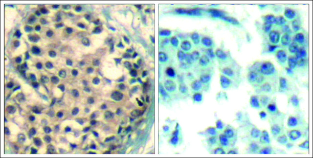 Anti-phospho-HDAC9/HDAC4/HDAC5 (pSer246/pSer259/pSer220) antibody produced in rabbit affinity isolated antibody